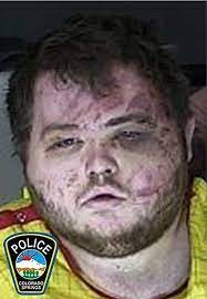 Colorado Gay Nightclub Mass Shooting Suspect Appears Bruised in Court