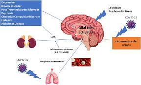 Acute Psychosis After COVID-19 Vaccination Alarming manuscripts report acute neuropsychiatric symptoms HEALTH VIEWPOINTS Dr. Peter A. McCullough Dr. Peter A. McCullough John Leake John Leake Jan 31 2023 biggersmaller