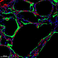 Scientists Find Natural Protein That Blocks COVID-19 Infection