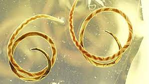 CDC Study Warns About Parasitic Brain Worms Found in Georgia
