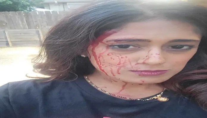 Minnesota Democrat Who Vowed to Dismantle Police Is Left With Broken Leg, Bloodied Face, After Violent Carjacking