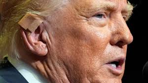 First Photos of Trump’s Ear Without Bandages After He Survives Attempted Assassination
